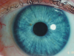 eye - blue